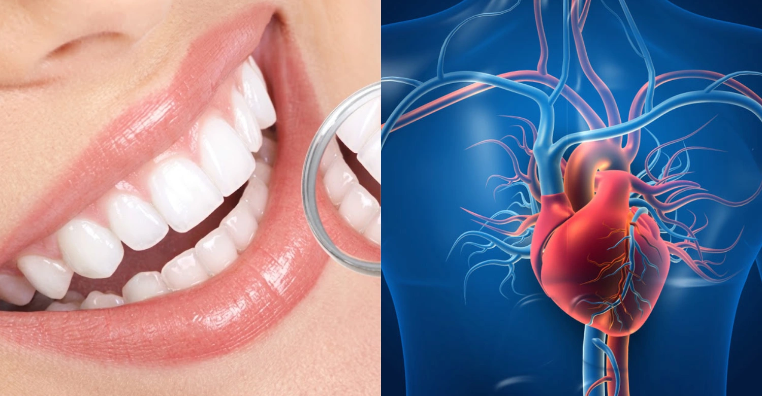 Aortic Dissection and Dental Treatment inblog
